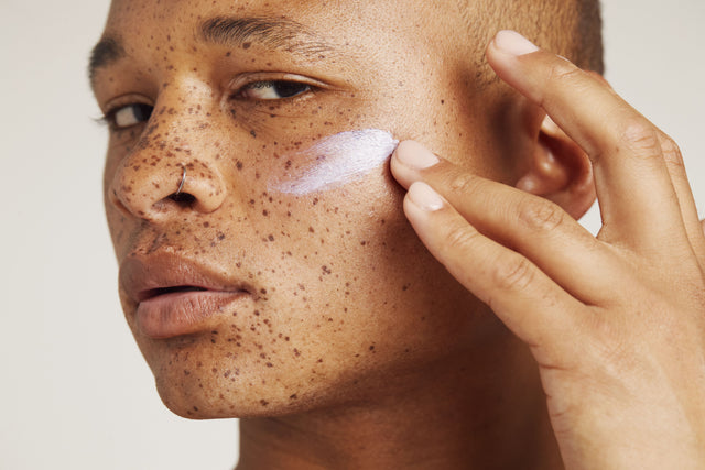 ACNE: IDENTIFICATION AND TREATMENT