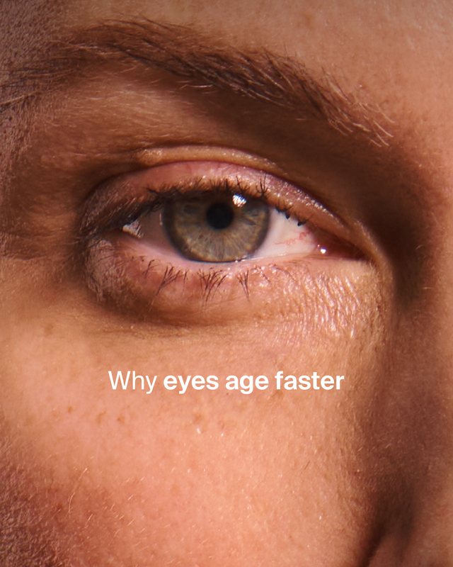 THE FACTS AROUND EYE AGING
