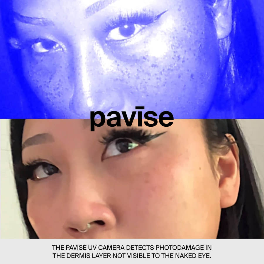 UV CAMERA